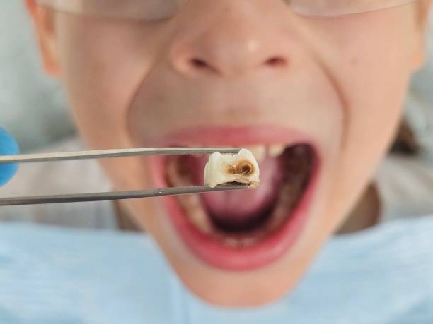 Best Urgent Dental Care for Toothache in Catlin, IL